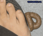 Stepped In Dog Poop