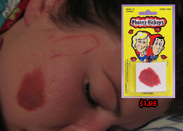 Fake Hickey