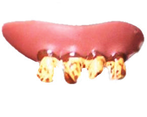 Hillbilly Teeth Joke