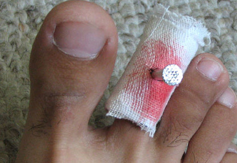 Nail Through Finger Prank